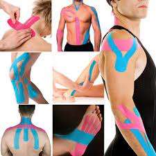 Vendaje neuromuscular