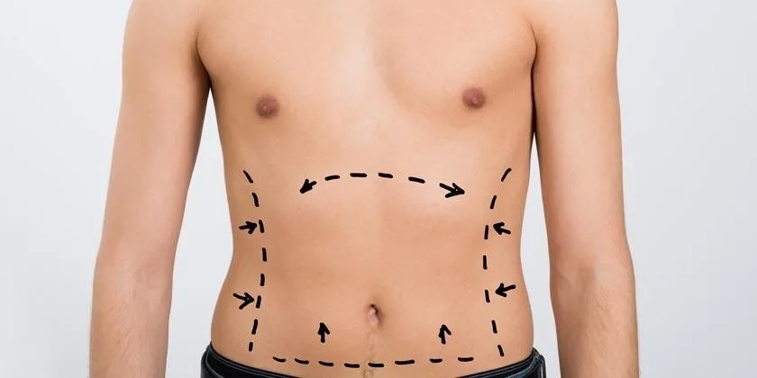 Masaje preoperatorio y postoperatorio